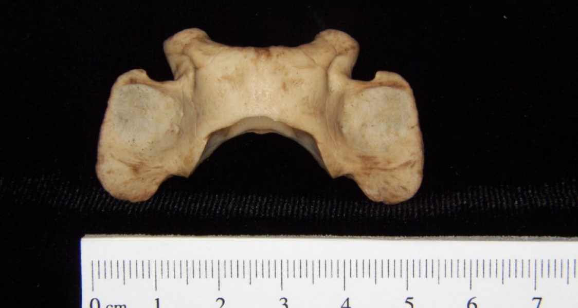 Superior View Bobcat C1 Vertebrae