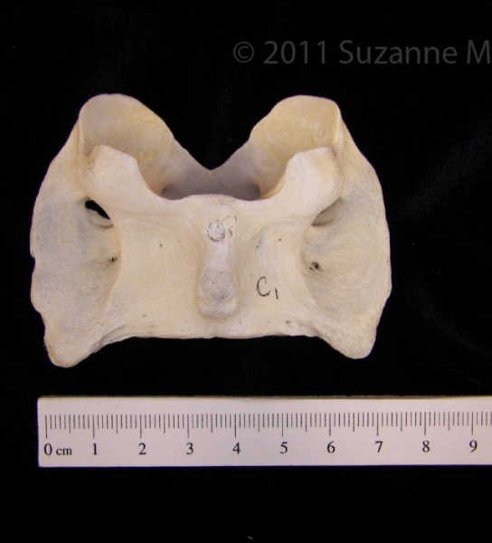 Inferior View Domestic Sheep C1 Vertebrae