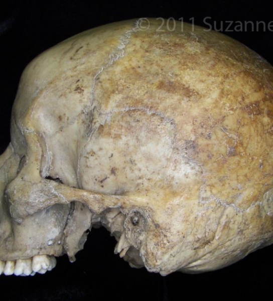 Lateral View Human Cranium