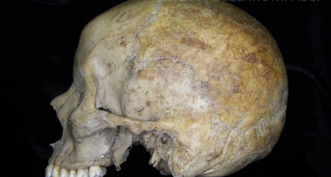 Lateral View Human Cranium