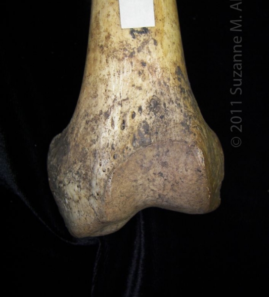 Anterior/Distal Aspect Left Human Femur