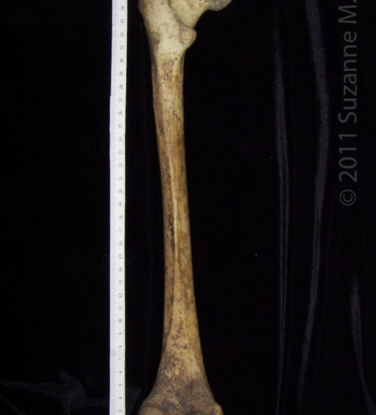 Posterior View Left Human Femur