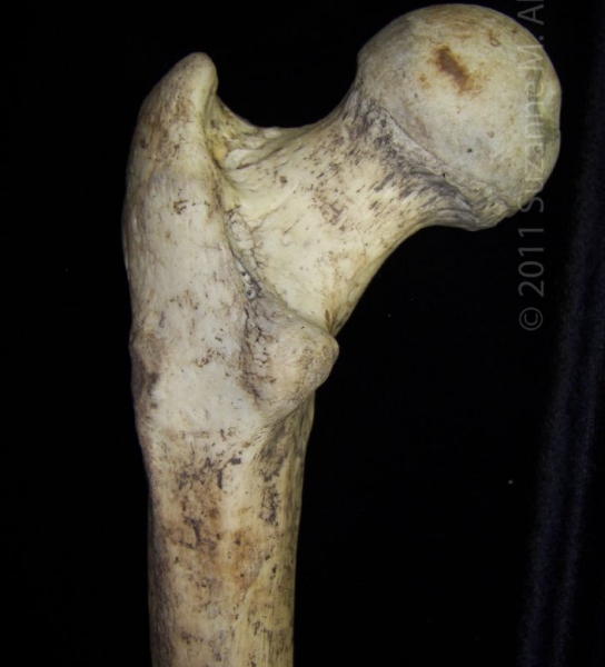 Proximal/Posterior Aspect Left Human Femur (Femoral Head)