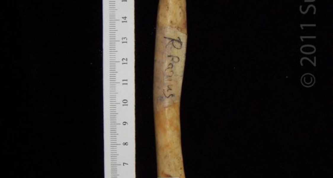 Anterior View Right Human Radius