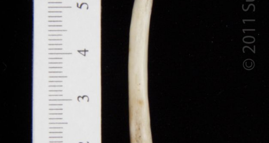 Posterior View Left Opossum Radius