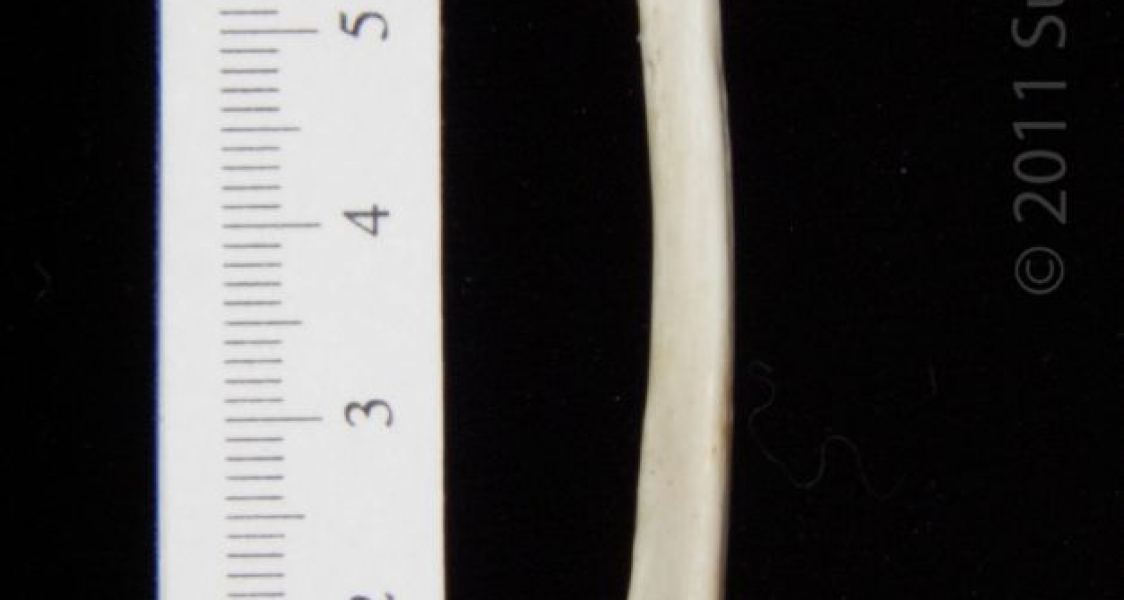 Anterior View Left Opossum Radius