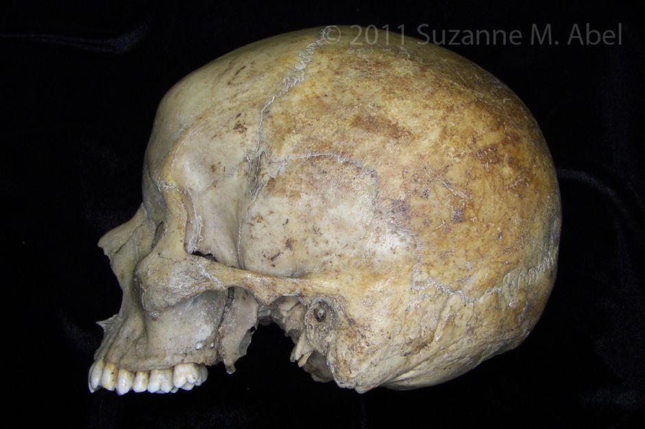 Lateral View Human Cranium