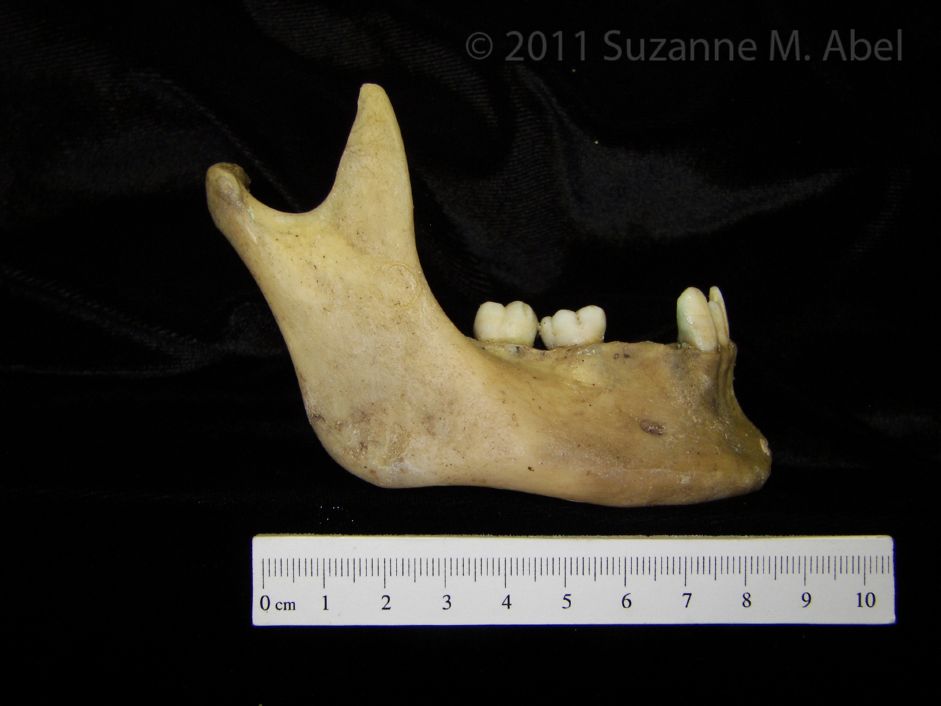 Lateral View Human Mandible