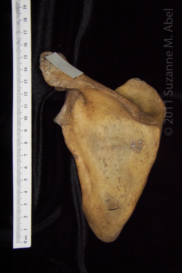 Posterior View Left Human Scapula