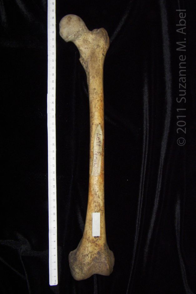 Anterior View Left Human Femur