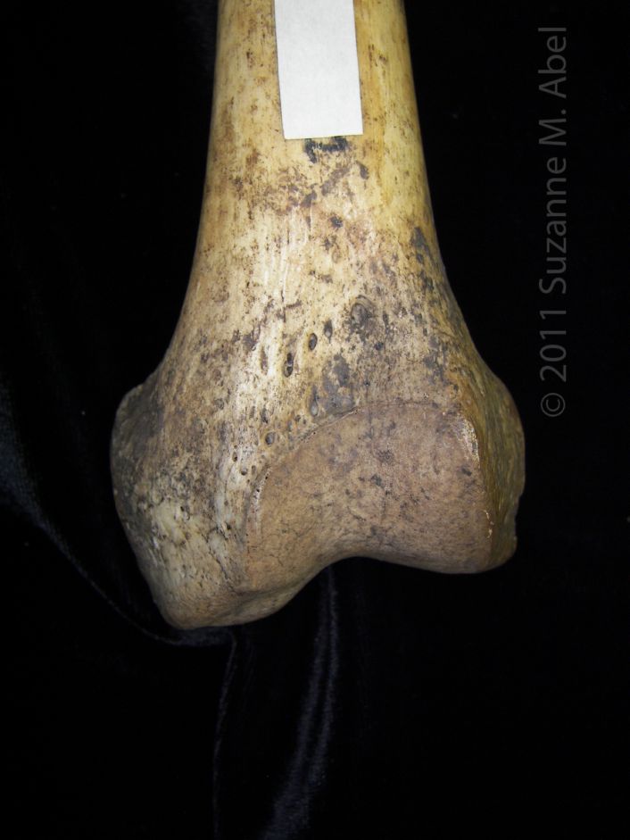 Anterior/Distal Aspect Left Human Femur