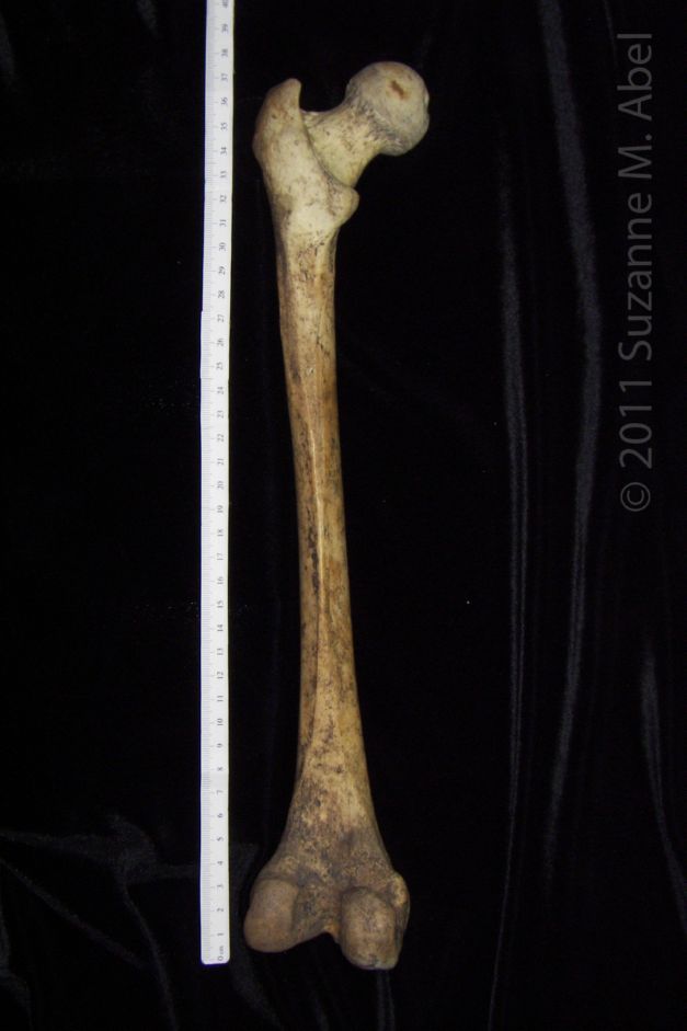 Posterior View Left Human Femur