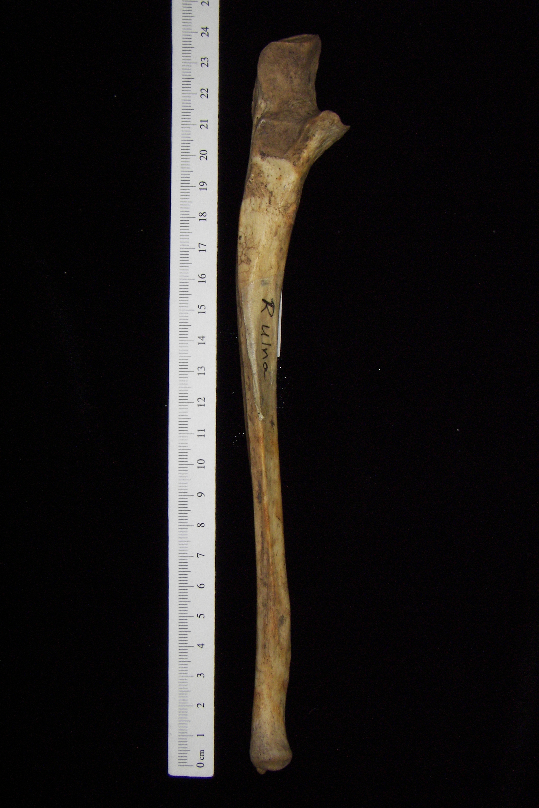 Anterior View Right Human Ulna