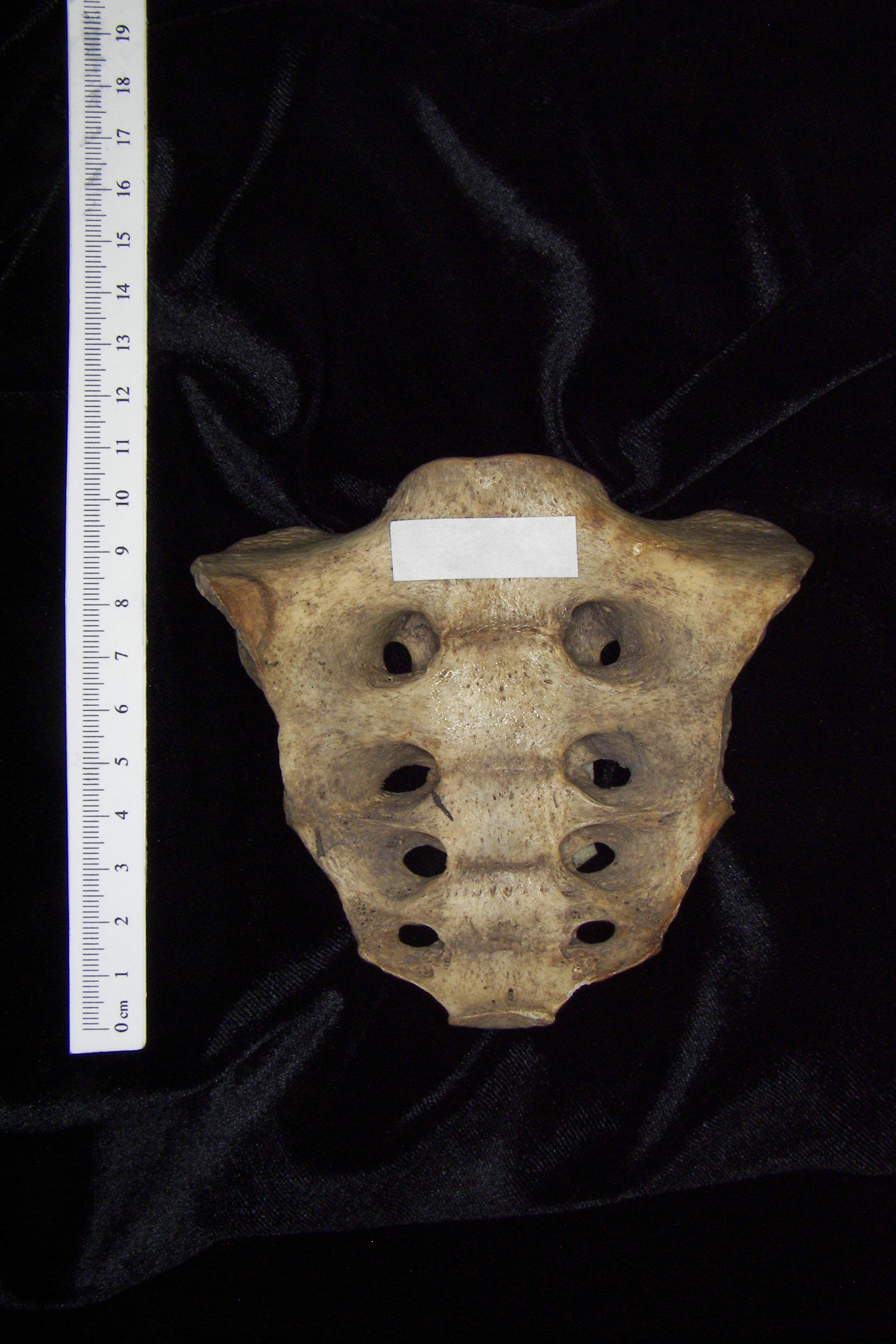 Anterior View Human Sacrum