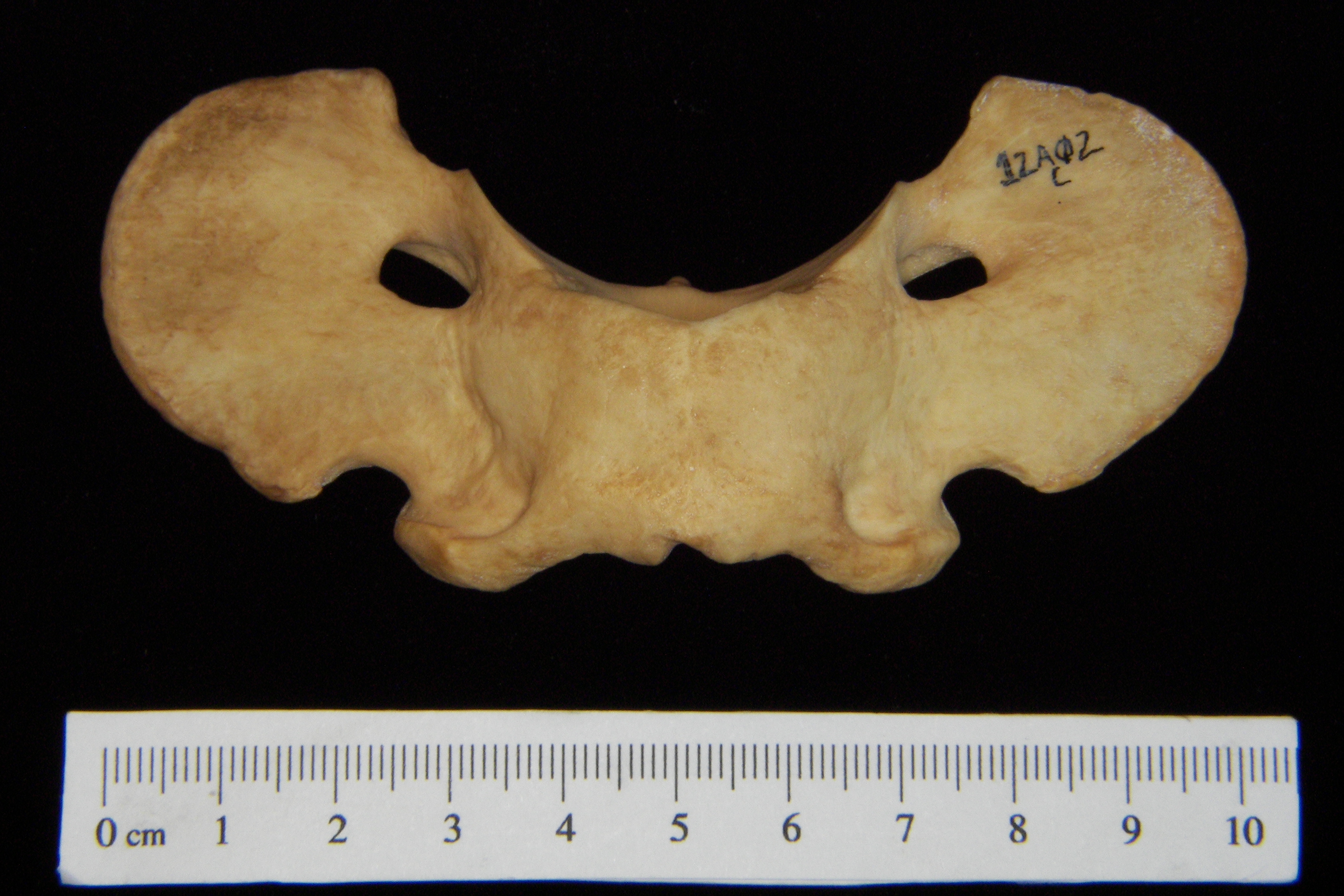 Dog (Canis lupus familiaris) C1 (1st cervical vertebra), superior view