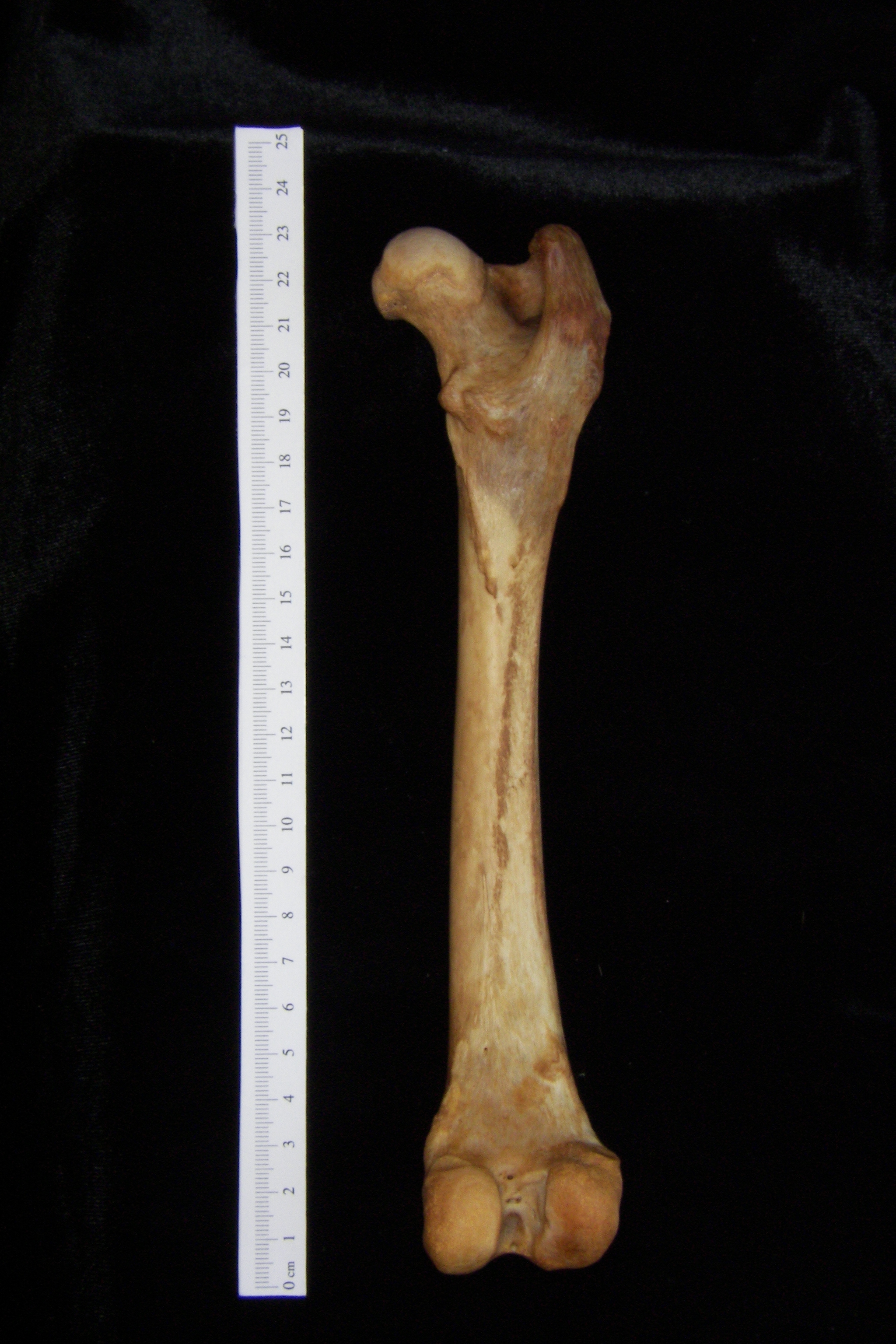 Dog (Canis lupus familiaris) right femur, posterior view