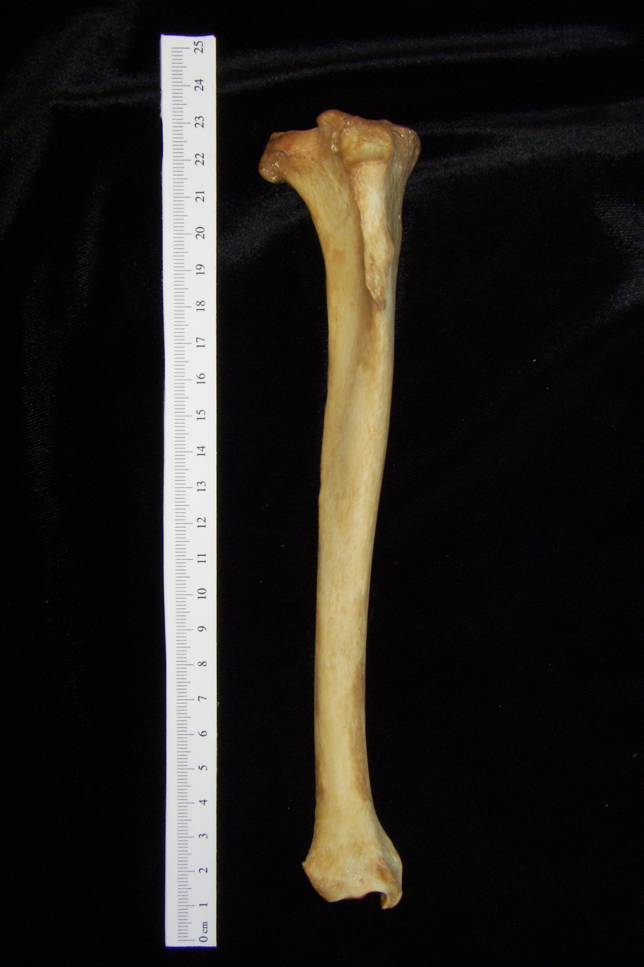 Dog (Canis lupus familiaris) right tibia, anterior view