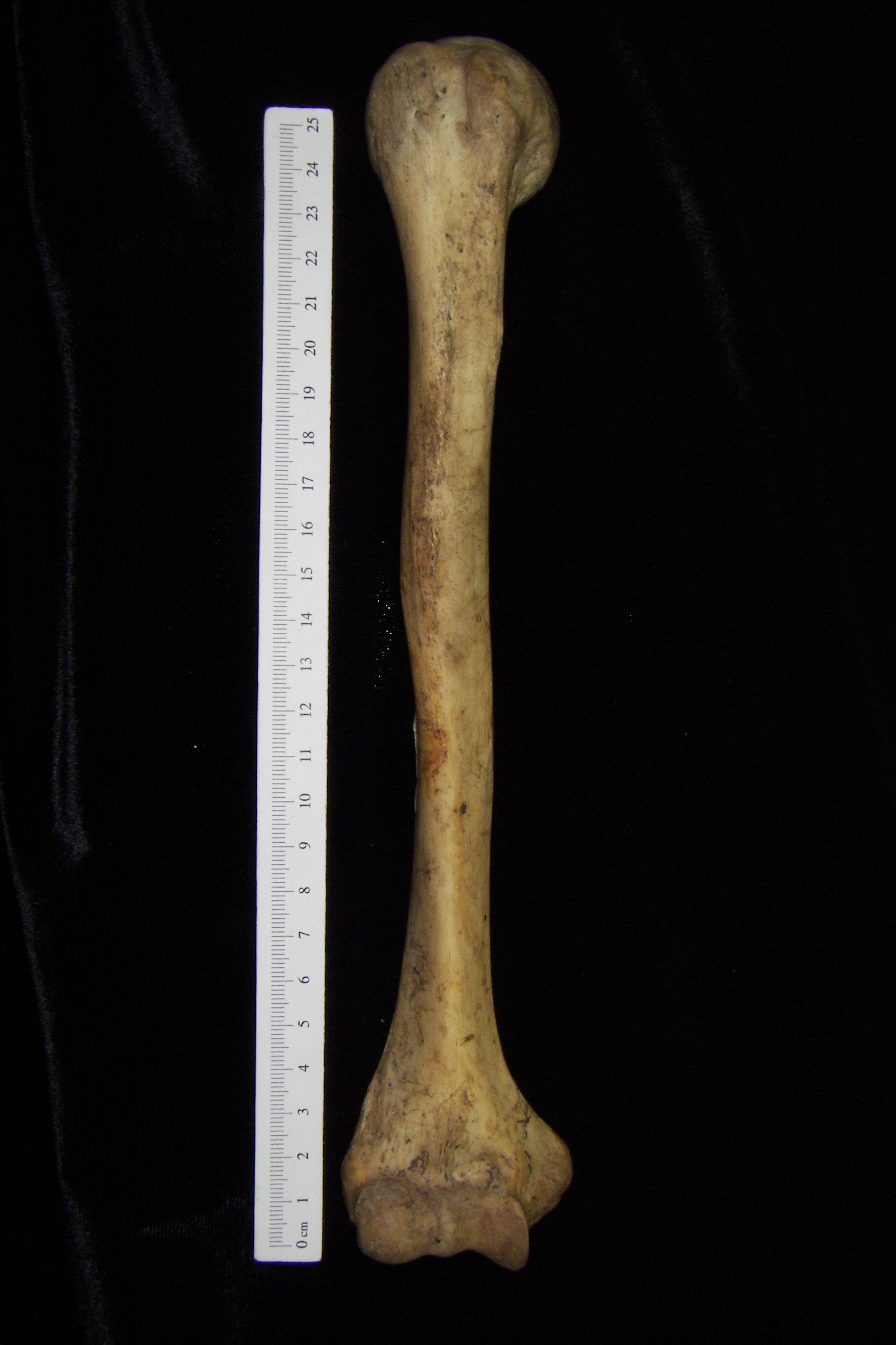 Human right humerus, lateral view