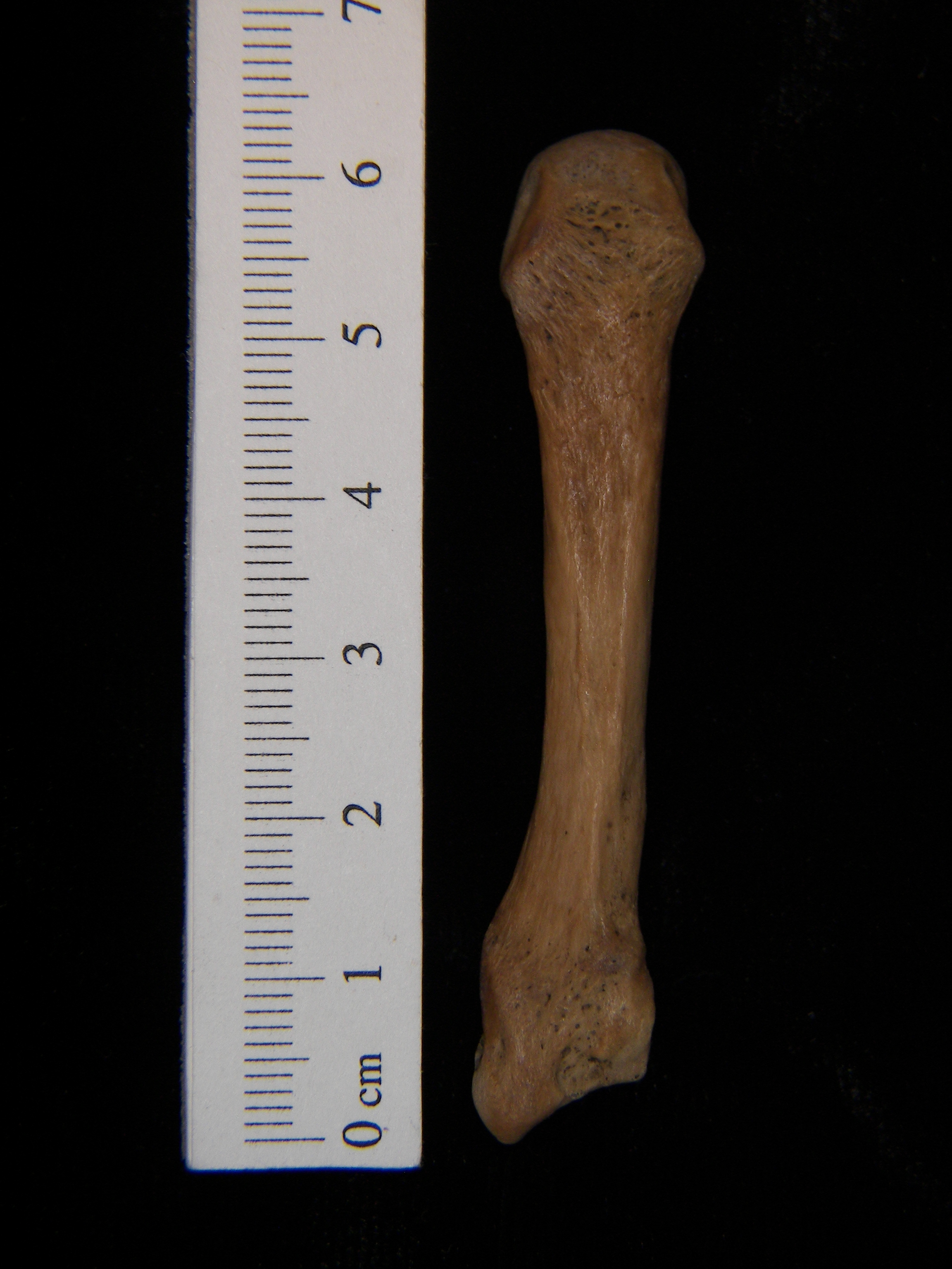 Human left 3rd metacarpal, dorsal view