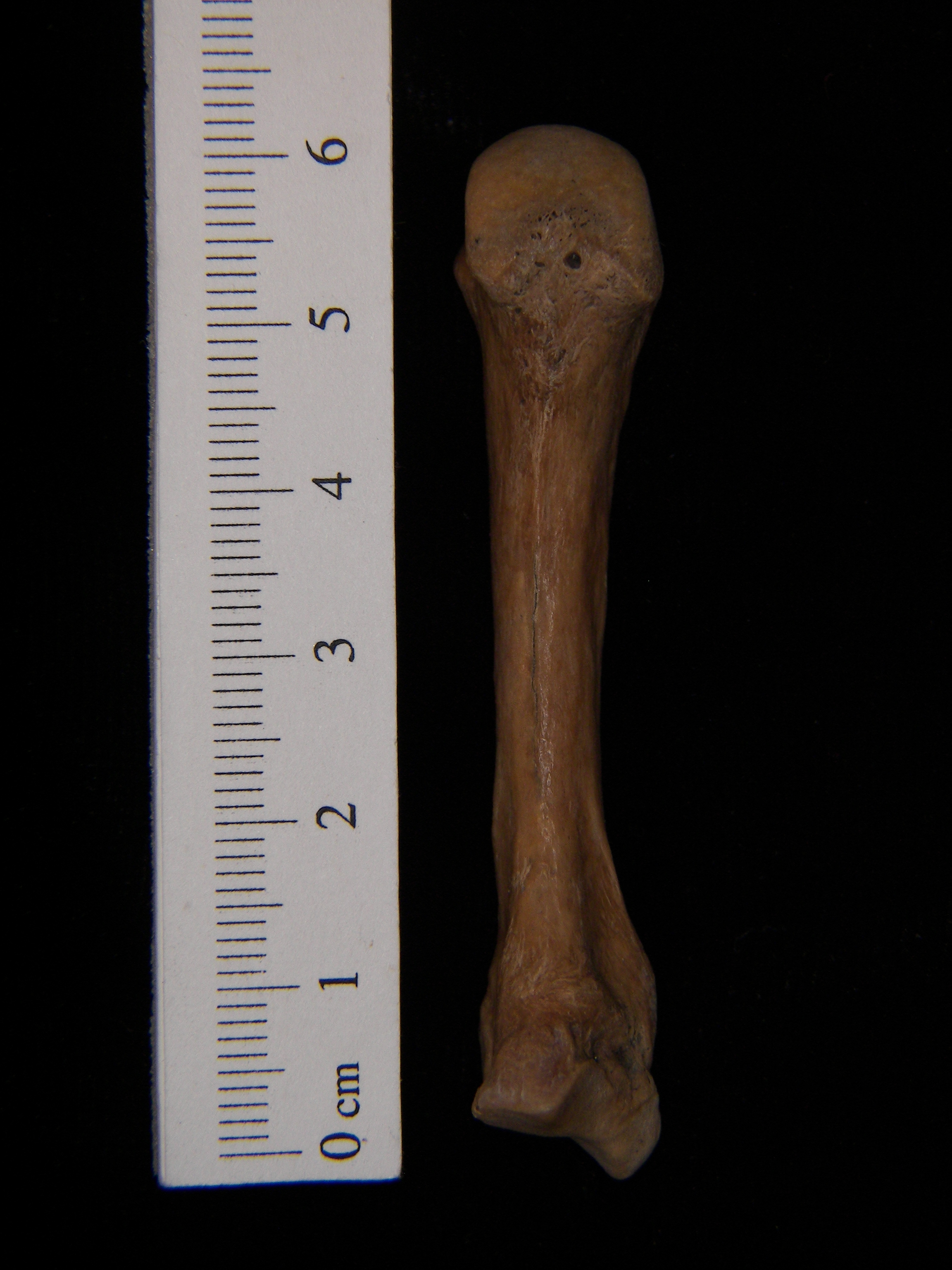 Human left 3rd metacarpal