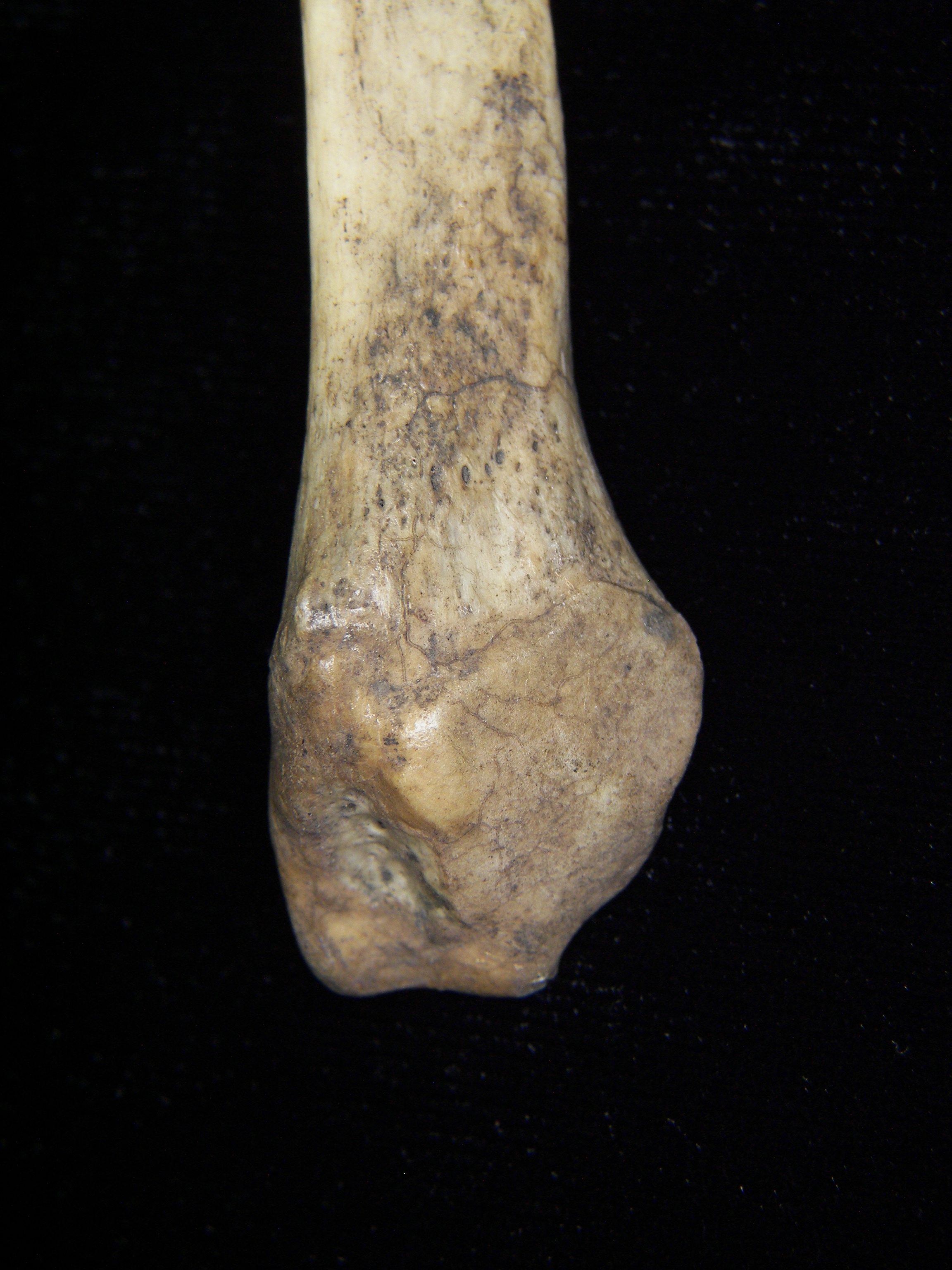 Human left fibula, distal aspect