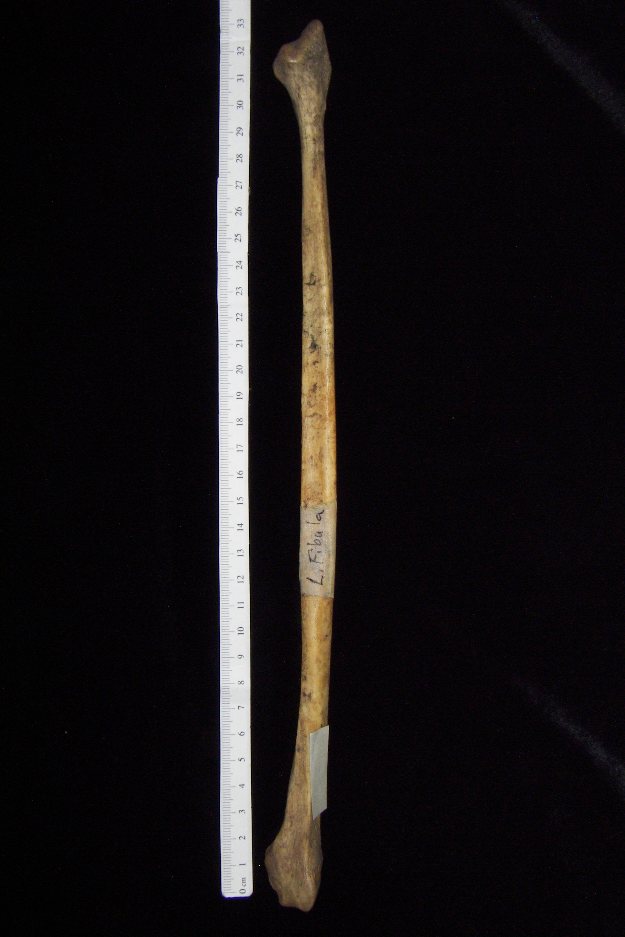 Human left fibula, lateral view