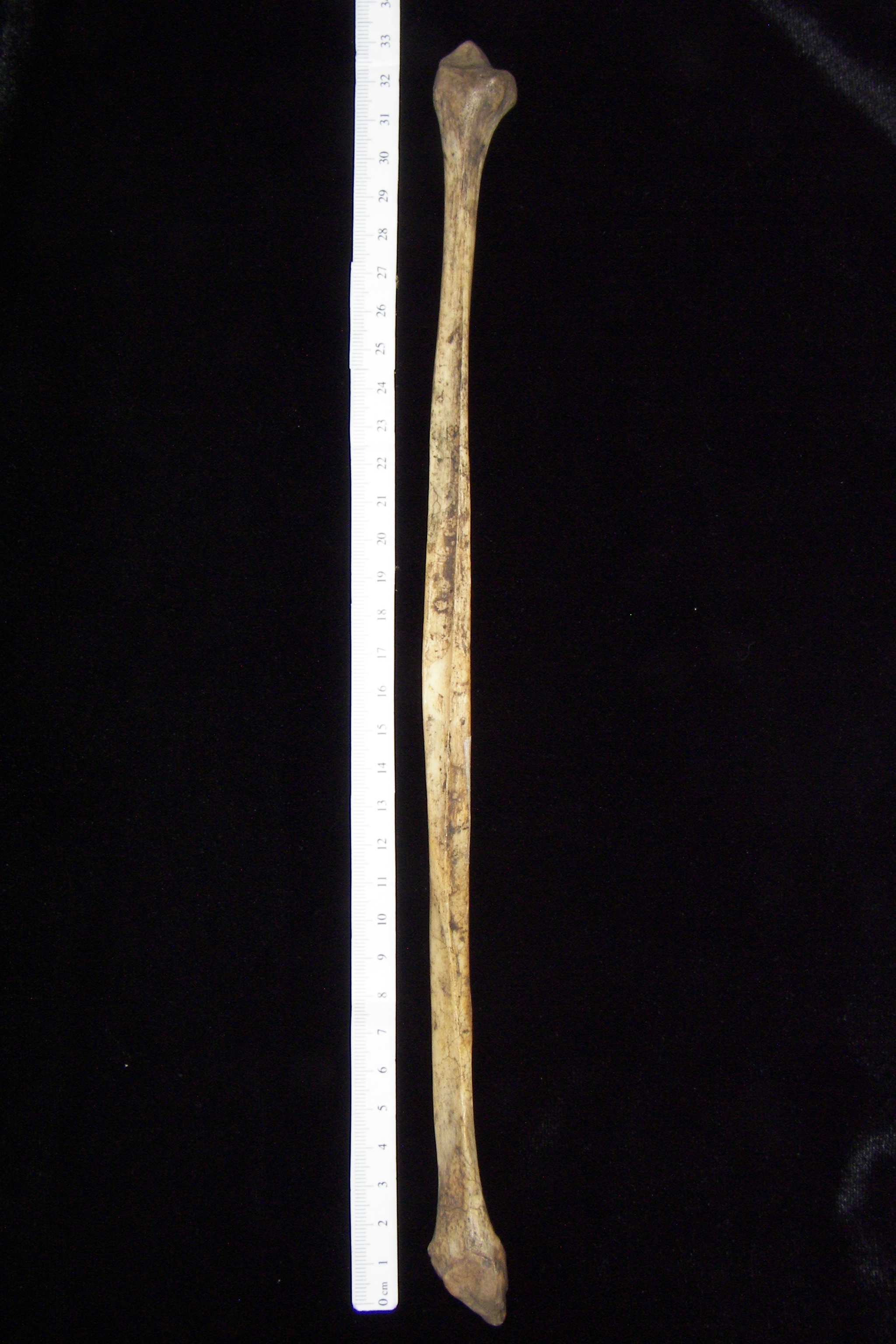 Human left fibula, medial view