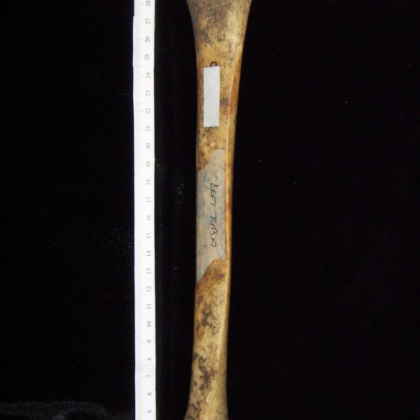 human-homo-sapiens-left-tibia-anterior-ccco