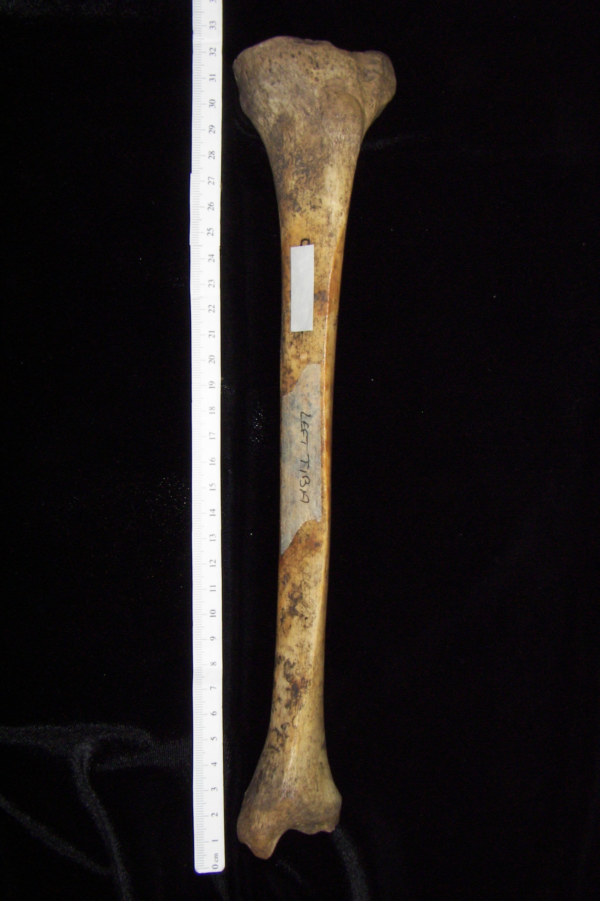 Human left tibia, anterior view