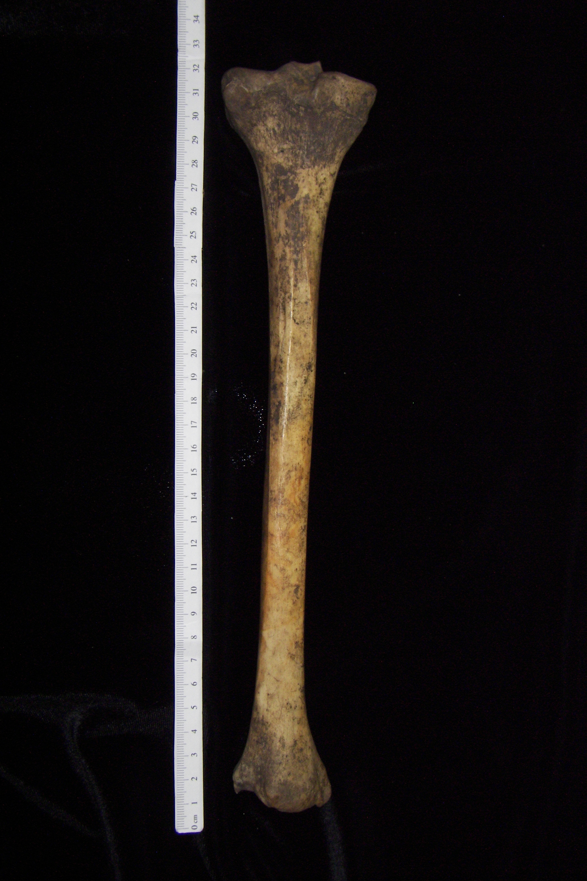 Human left tibia, posterior view
