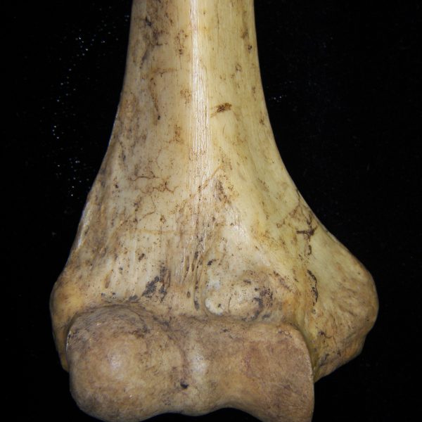 human-homo-sapiens-right-humerus-distal-anterior-aspect-ccco