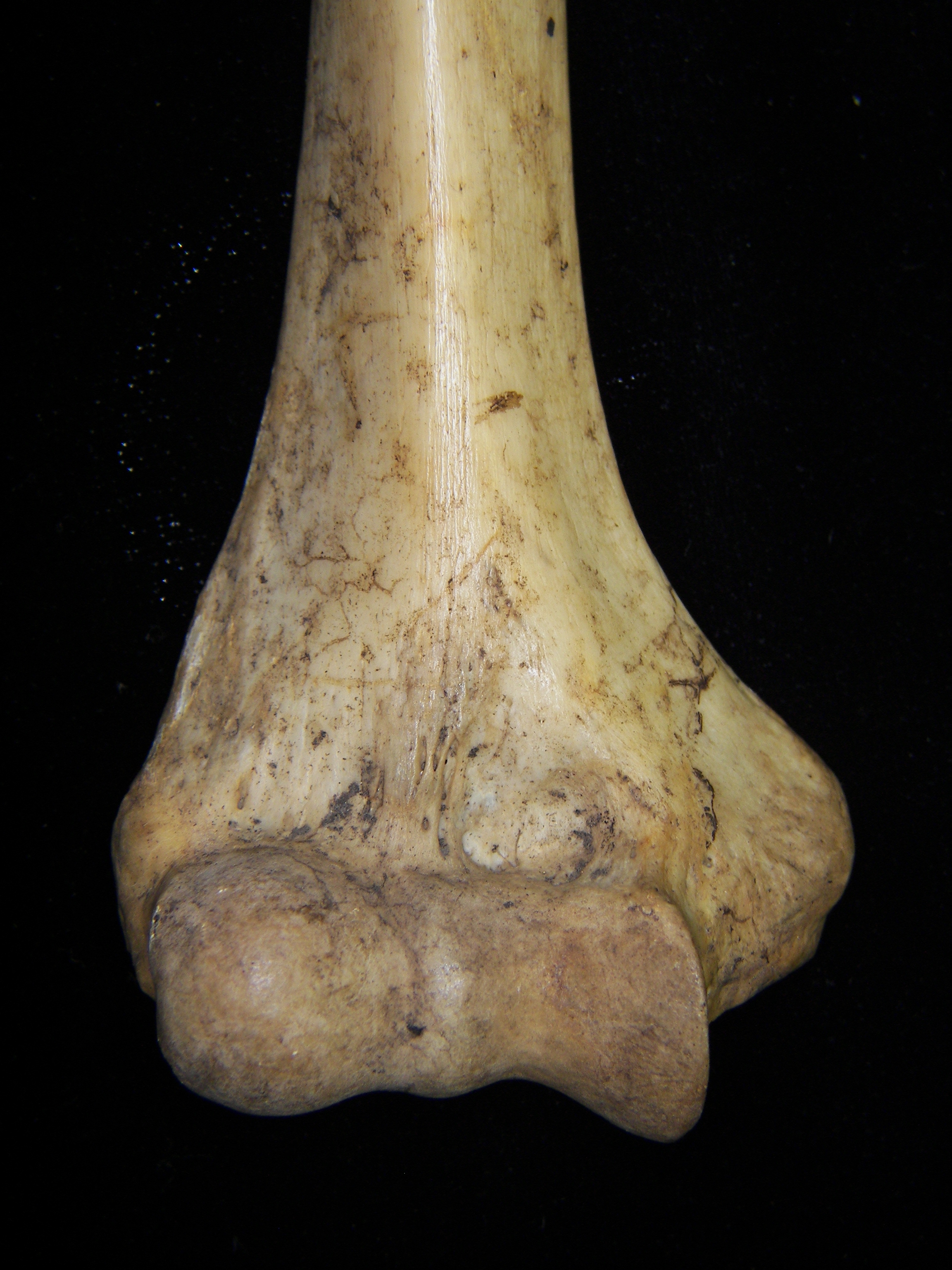 Human right humerus, distal aspect, view 2