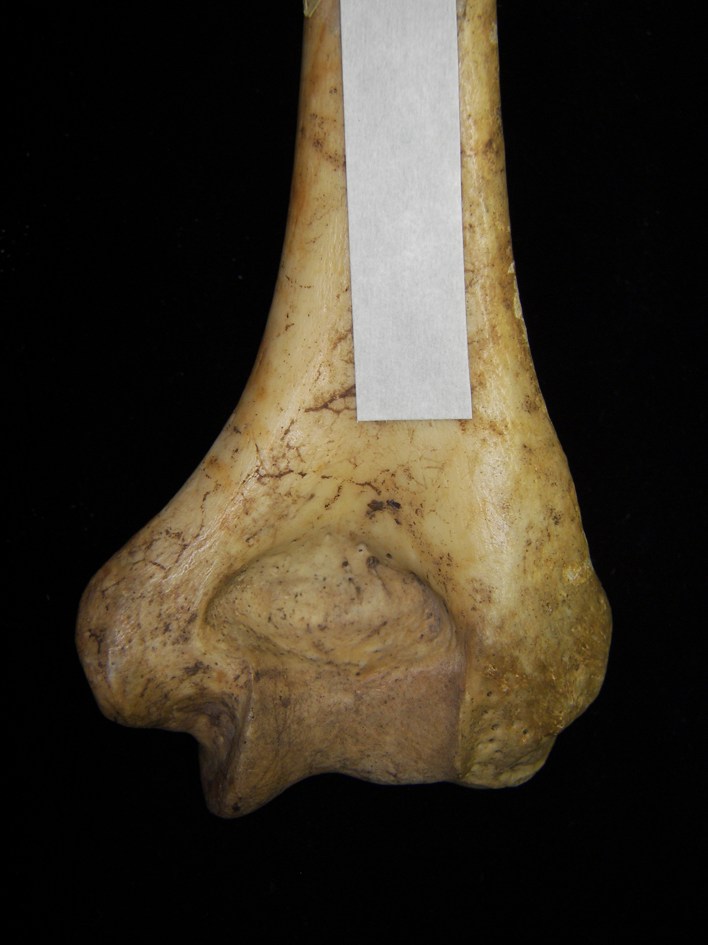 Human right humerus, distal aspect