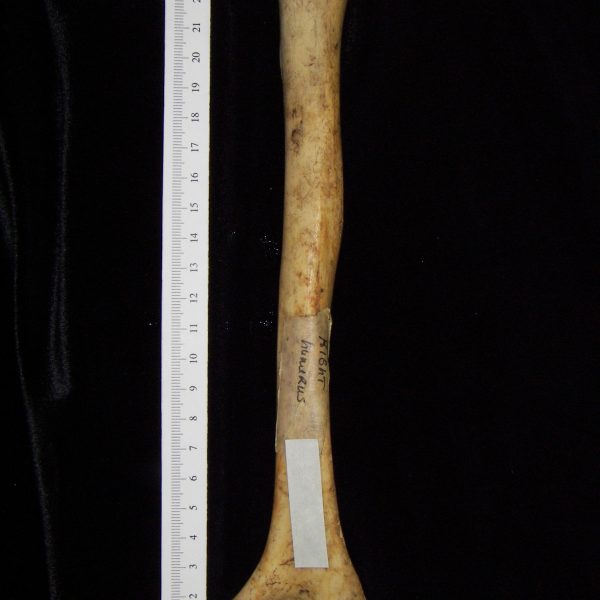 human-homo-sapiens-right-humerus-posterior-ccco