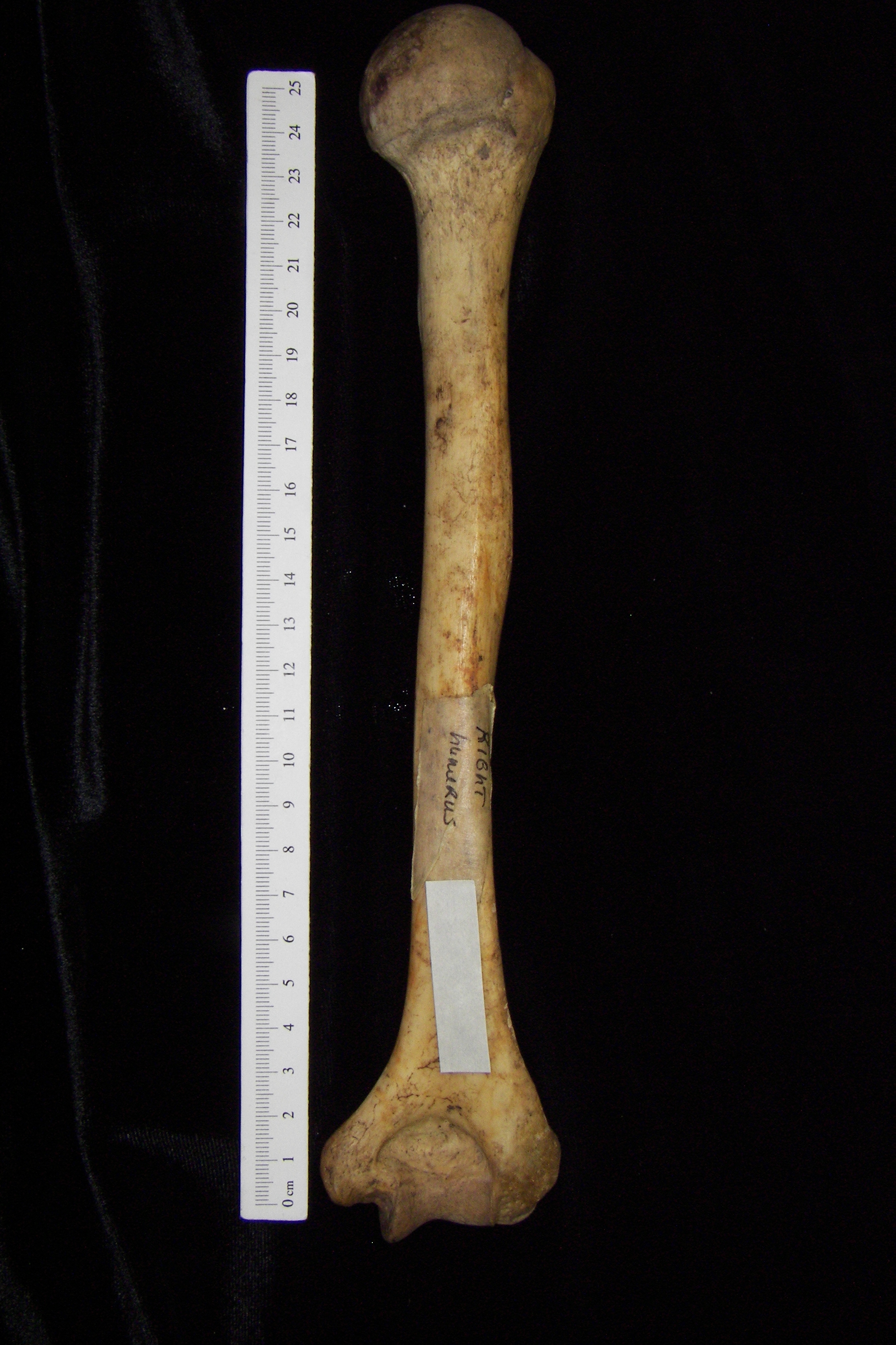 Human right humerus, posterior view